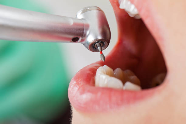Best Emergency Broken Tooth Repair in Elkader, IA